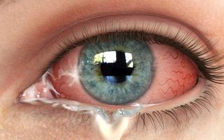 Виды и причины появления выделений в уголках глаз